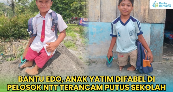 Bantu Edo, Anak Yatim Difabel Di Pelosok NTT Terancam Putus Sekolah