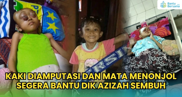 Kaki Diamputasi Dan Mata Menonjol, SEGERA Bantu Dik Azizah Sembuh
