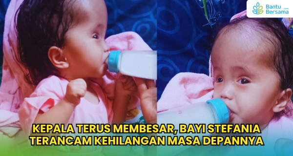 Kepala Terus Membesar, Bayi Stefania Terancam Kehilangan Masa Depannya
