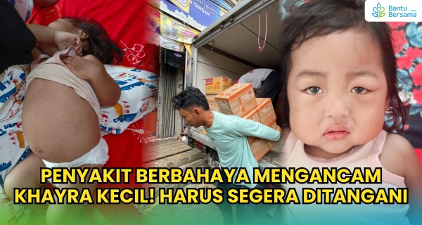 Penyakit Berbahaya Mengancam Khayra Kecil, Harus Segera Ditangani