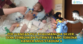 Ayah Jadi Manusia Silver Demi Pengobatan Anaknya