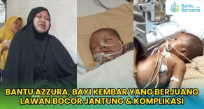 Bantu Azzura, Bayi Kembar Yang Berjuang Lawan Bocor Jantung & Komplikasi