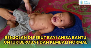 Benjolan Di Perut Bayi Berumur 2 Tahun, Bantu Anisa Berobat Dan Kembali Normal
