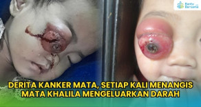 Khalila, Bocah Kecil Dengan Kanker Mata Yang Menangis Darah