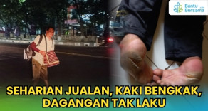 Seharian Jualan, Kaki Bengkak, Dagangan Tak Laku