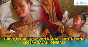 Tubuh Penuh Luka Dan Nanah, Bantu Nana Segera Jalani Operasi