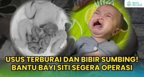 Usus Terburai Dan Bibir Sumbing! Bantu Bayi Siti Segera Operasi